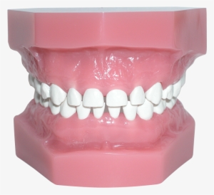 Pedo Model With High Heat Teeth - Human Tooth #326671