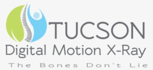 Seeing Instability - Tucson Digital Motion Xray #3219686