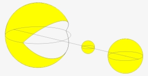 Http - //i - Imgur - Com/zomuxxr - Cbs Eye Pacman #3226396 Http - //i - Imgur - Com/zomuxxr - Cbs Eye Pacman #3226396