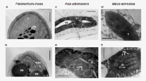 The Changes In Plastid Ultrastructure Of Microalgae - Medical Imaging #3268284