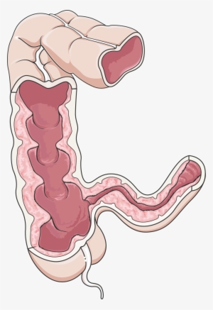 Similar - Large Intestine #3286450
