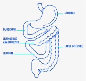 Jejunocolic Anastomosis And The Digestive System - Human Digestive System #3286556