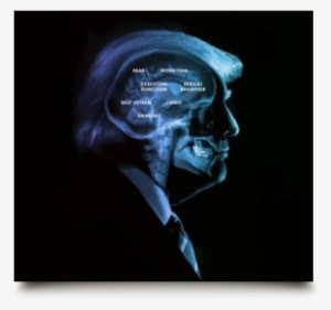 #267 / Who Decides - Mental Fitness #338000