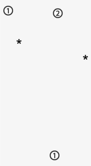 Because The Horse Is Very Lean, The Mesojejunum Is - Circle #3307281