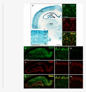 Raprnp Vector Drives Expression In Rat Neurons - Visual Arts #3316850