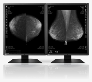 1cm Monochrome Lcd Monitor - Radiforce Gx550-p-bk - 21.3" Ips Led Monitor - 4:5 #3386114