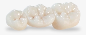 Bruxzir® Solid Zirconia Crowns And Bridges - Zirconia Crowns And Bridges #3391855