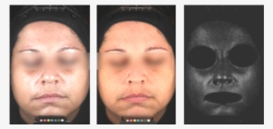 Equipamentos & Avaliações - Scar #3423322 Equipamentos & Avaliações - Scar #3423322