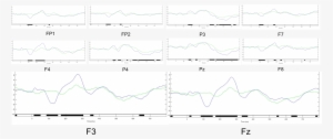 Results Of Erps On 10 Channels With A Significant Difference - Diagram #354004