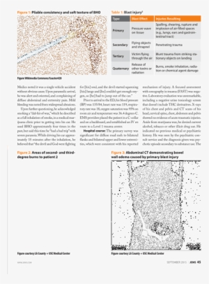 Help - - Document #354019