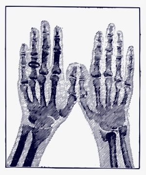 This Free Icons Png Design Of X-ray Image #3505827