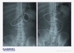 Gftb Casestudies Email 021517-1 - Medical Imaging #3506002