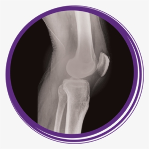 Photo Of An X-ray Of A Knee Joint - Rochelle Community Hospital #3506174