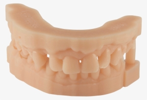 Dental Material 3d Printing For Dental Parts - 3d Printed Dental Model #3526334