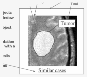 The I 2 Cnet Annotation Format Promotes The Expression - Diagram #3537950