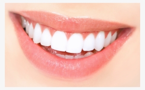 Perfect Smile2 #3545918