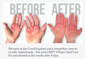 By The Time The Skin Rips Off, It Will Be A Lot Dryer - Jergens Wet Skin Natural Glow #3553955 By The Time The Skin Rips Off, It Will Be A Lot Dryer - Jergens Wet Skin Natural Glow #3553955