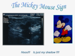 Mickey Mouse Sign - Mickey Mouse #368953