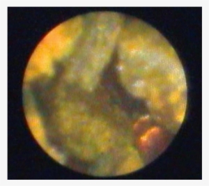 Spyglass™ Direct Visualization System - Earth #3600297