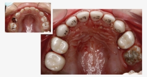 That Looks Natural, And Is Strong And Long Lasting - Ez Pedo Crown #3600592