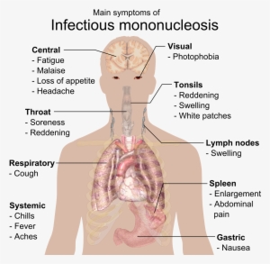 Main Symptoms Of Infectious Mononucleosis - Epstein Barr Virus #3600960