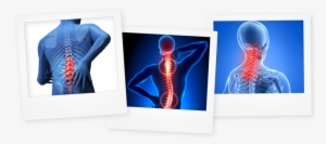 Polaroid Images Of A Persons Back With Key Areas Clearly #3694960