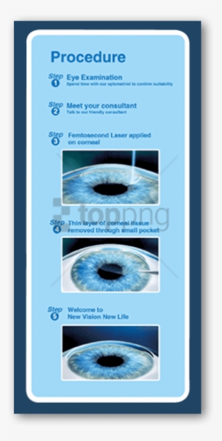 Relex Smile Is A Less Invasive Way To Treat Short-sightedness - Circle #372312