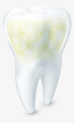 Une Dent Blanche Et Saine À Côté D'une Dent Jaunie - Acid #376806