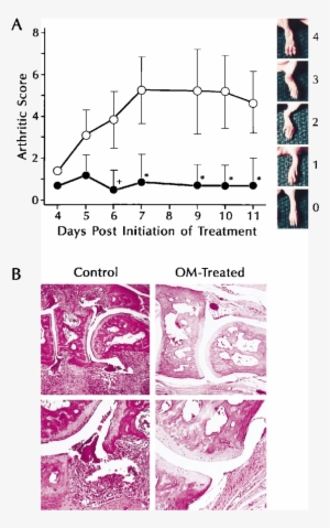 Nhibition Of Eae By Om - Diagram #3716813