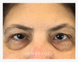 Dr Dav - Close-up #3753502