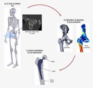 Continuum Blue Fretting Wear And Fatigue Analysis Of - Afl Football Field Template #3798046
