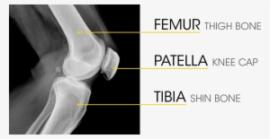 Knee Anatomy - Bone Knee #3798236