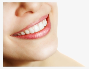 Dentist Smile Png File - Billy Bob Instant Smile Deluxe Costume Teeth: Medium #386828