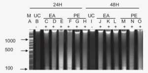 Effect Of Ea And Pe (petroleum Ether) Extracts On Dna - Number #3815917