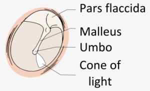 Tympanic Membrane Pars Flaccida #3818349