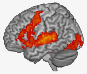 Your Brain On Words - Functional Magnetic Resonance Imaging #3836782
