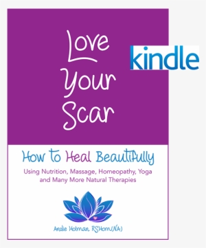 Love Your Scar - Love Your Scar By Andie Holman #3859985