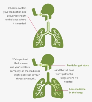 About Inhalers - Patient #3871897