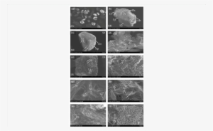 3a And 3b) Grain Exhibits Angular (an), High Relief - Figs #3881294