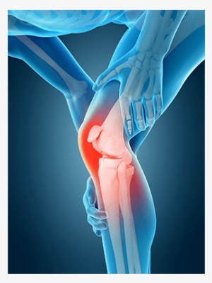 Knee Pain - Rodilla 3d #3894989