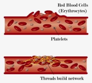 Blood Clot Formation - Damage Of Blood Vessels #3931204