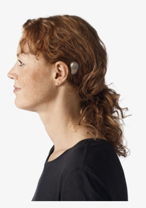 The Sound Processor From Oticon Medical Behind The - Bone Anchored Hearing Aid Nz #3951419