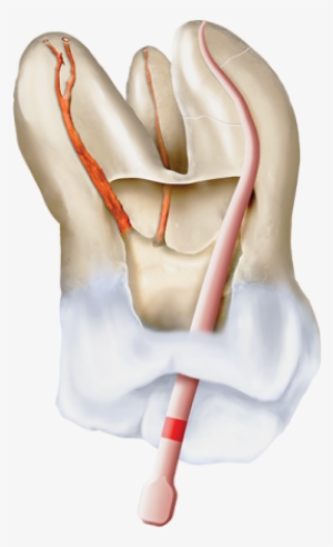 Conform Fit Gutta-percha Points - Carmine #3967746