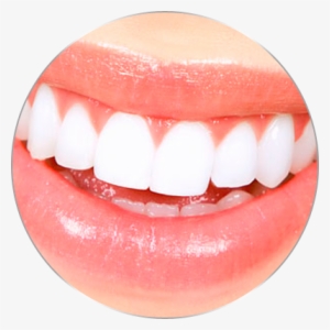 If You Are Not Satisfied With Your Current Smile Or - Oriole Park At Camden Yards #3977677