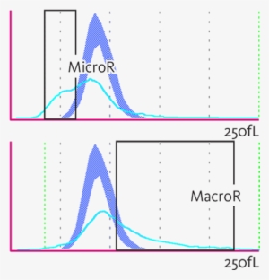 Red Blood Cells - Rbc Histogram Macrocytic Anemia #3995636