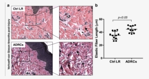 Effect Of Adrcs On Elastic Fiber Length - Flower #4010965