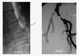 Identification Of The Causative Disease Through Walking - Leg #4012249