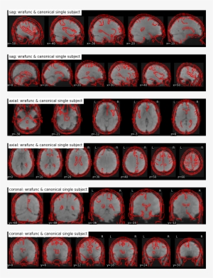 Spm8 231 Kb - Circle #4040253