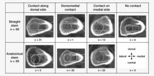 Location Of Contact Between The Internal Calcar Septum - Nasal Septum #4061976
