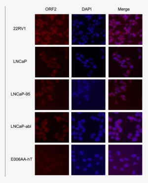 Immunofluorescence Of Endogenous Orf2p In A Panel Of - Norcantharidin #4080054